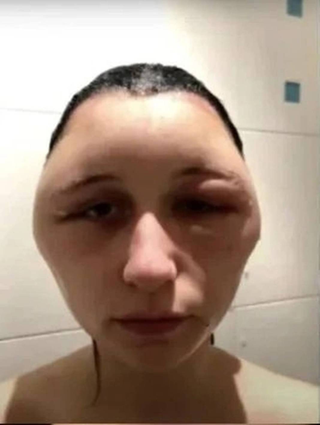 Marketten aldığı ürünle saçını boyadı: Kafası ampul gibi şişti! Yakınları bile tanıyamadı 17